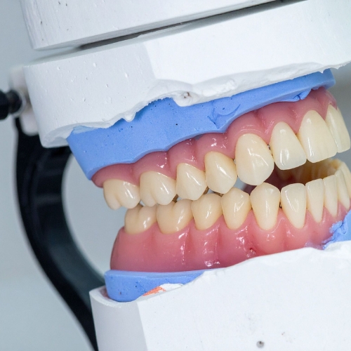 Complete & Partial Denture